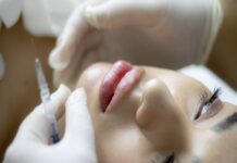 Come rimodellare il corpo prima del matrimonio con trattamenti estetici Come rimodellare il corpo